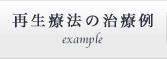 再生療法の治療例